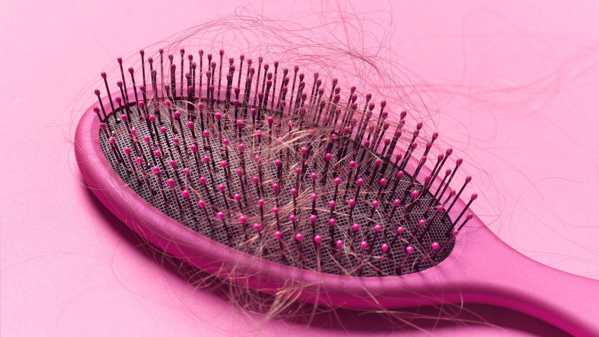 O que é alopecia areata e o que ela tem a ver com a saúde mental?
