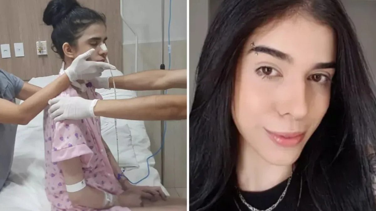 Jovem que teve reação alérgica ao cheirar pimenta deixa a UTI; relembre o caso