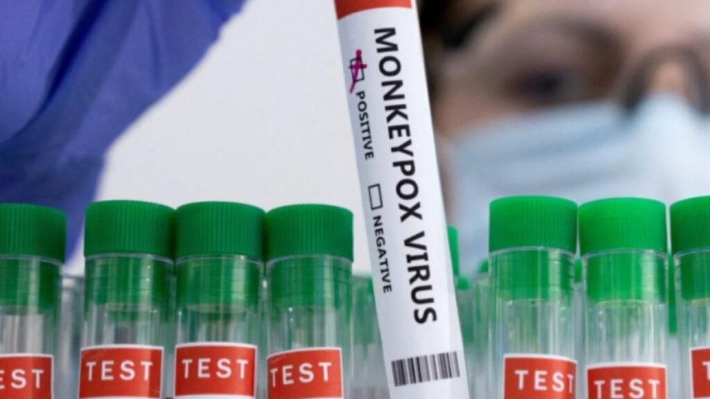 Brasil registra 1,5 mil casos de mpox em 2024