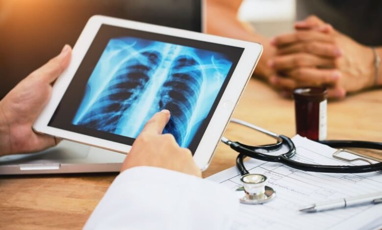 SRAG: quais vírus podem levar ao quadro que causou emergência?