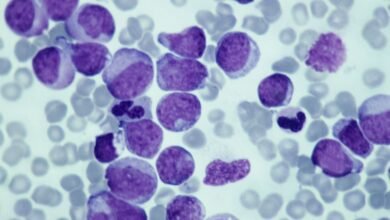 Novo estudo descobre como proteína afeta crescimento de células de câncer