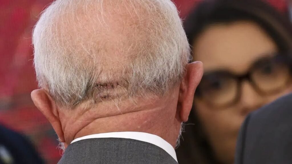 Lula é acusado de ‘mentir’ sobre acidente para vetar Venezuela no Brics