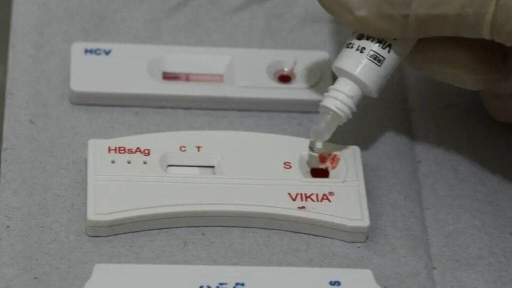Farmácias poderão realizar testes rápidos de HIV e sífilis