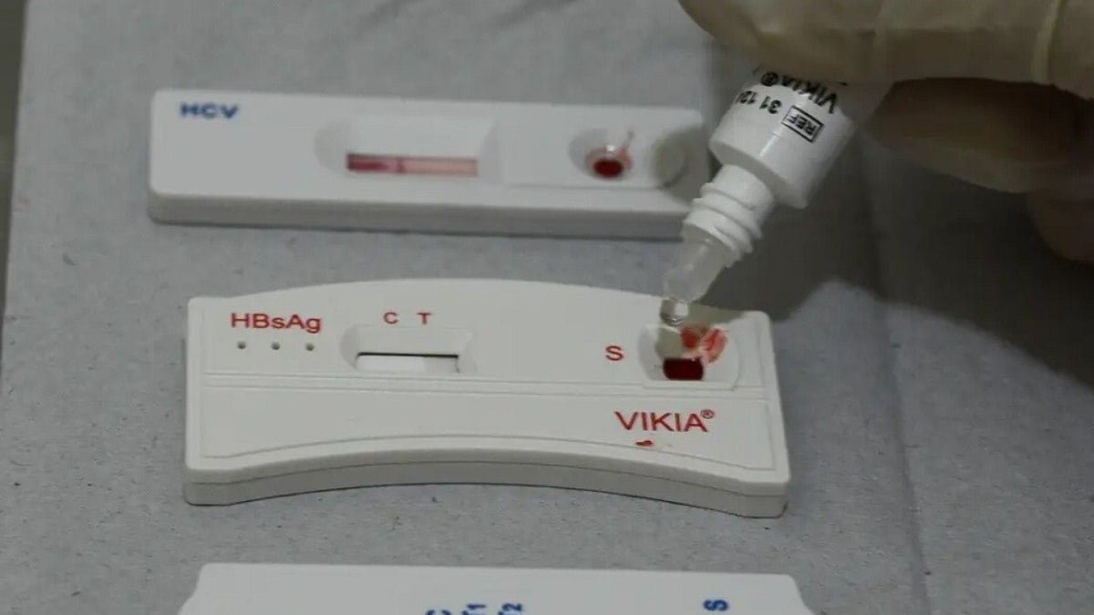 Farmácias poderão realizar testes rápidos de HIV e sífilis