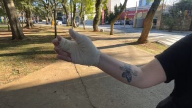 Mulher é atacada por pitbull ao proteger cachorra em praça