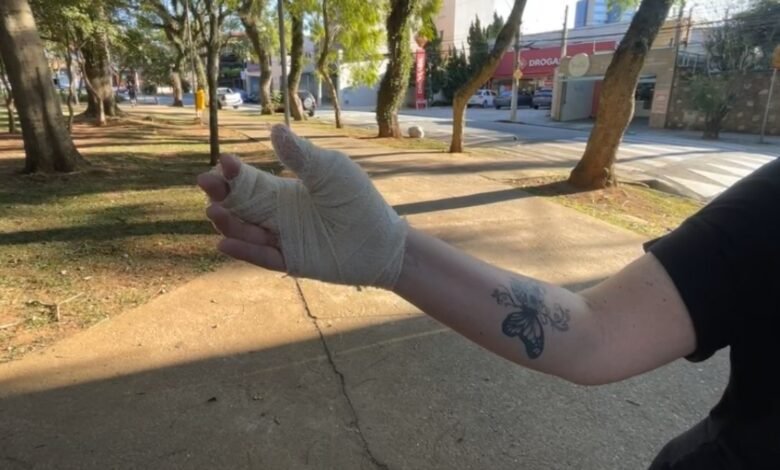 Mulher é atacada por pitbull ao proteger cachorra em praça