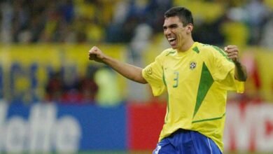Lúcio mostra o rosto pela primeira vez após sofrer queimaduras