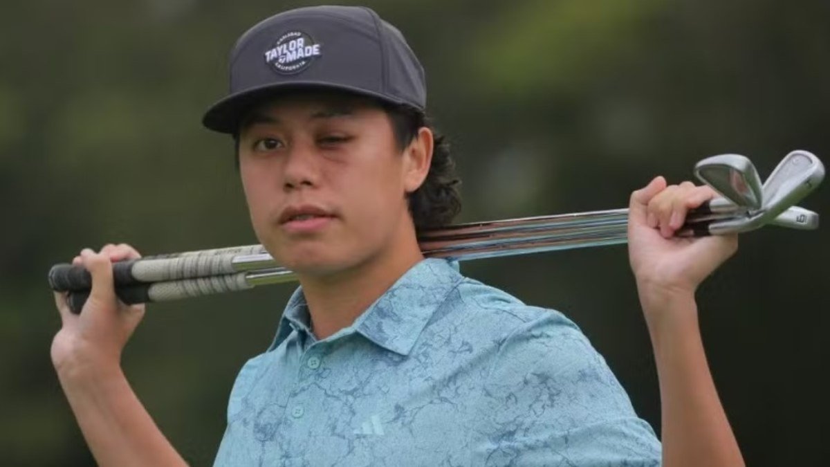Golfista leva bolada durante competição e perde visão do olho esquerdo