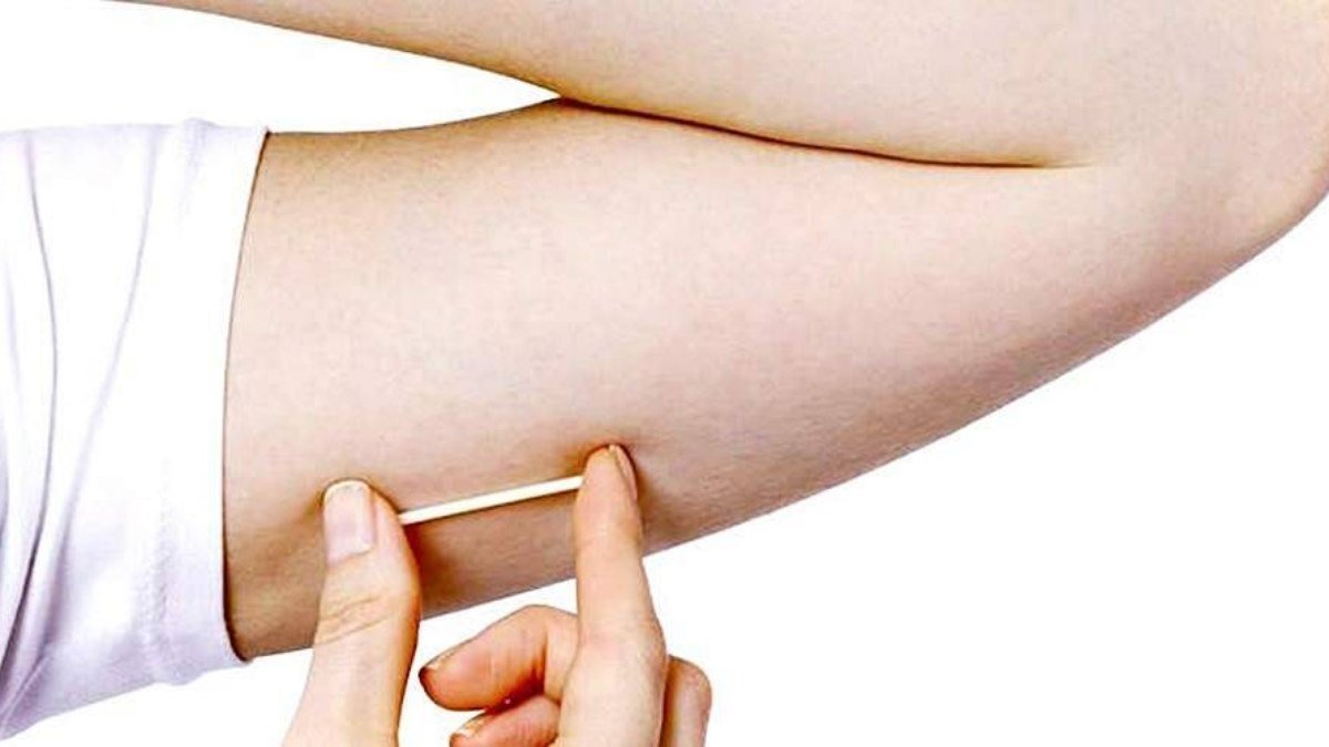 O que é o implante hormonal? Conheça mitos e verdades