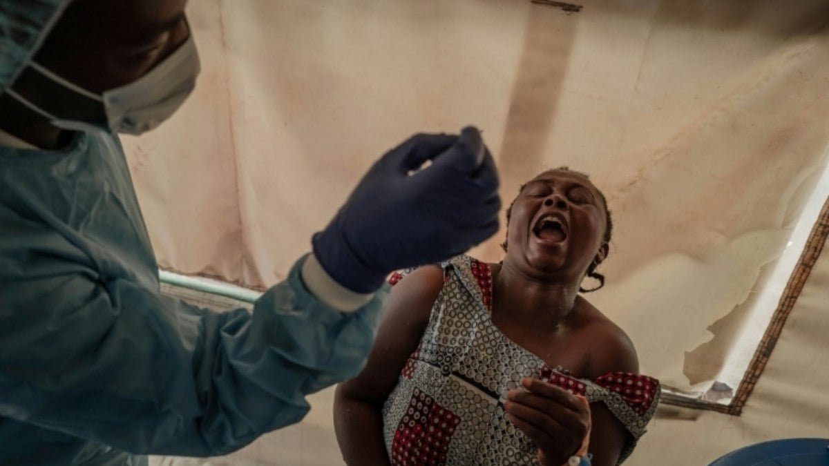 Casos de mpox crescem na República Democrática do Congo