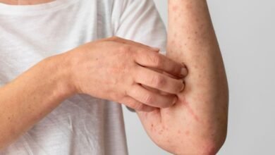 Casos de Herpes-Zóster no Brasil crescem; médicos explicam a doença