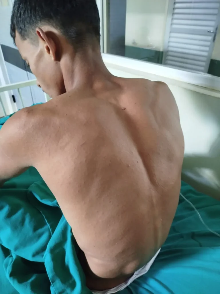Jovem resgatado após desaparecer na mata recebe alta hospitalar | ac24horas