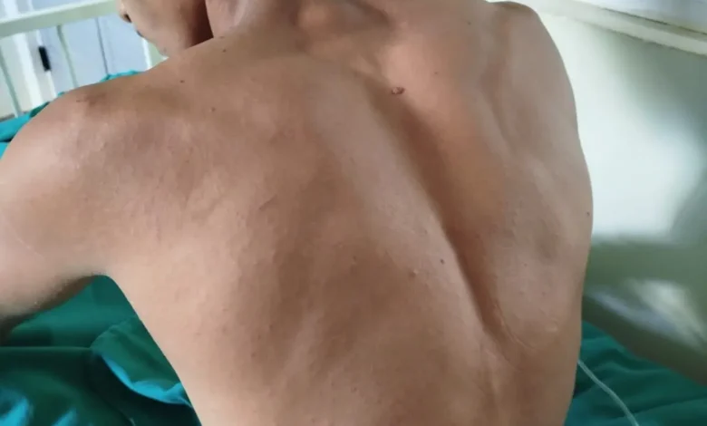 Jovem resgatado após desaparecer na mata recebe alta hospitalar | ac24horas Jovem resgatado após desaparecer na mata recebe alta hospitalar | ac24horas