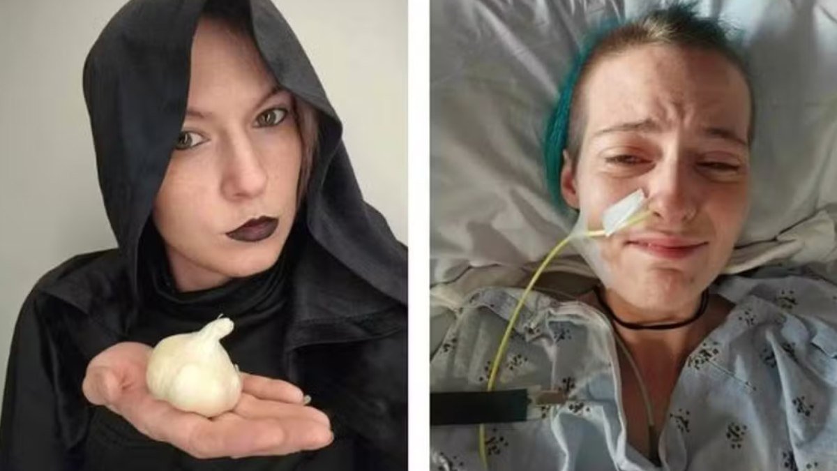 distúrbio raro pode até levar à morte por ingestão de alho