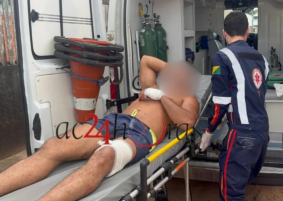 Sargento da PM do Acre é baleado acidentalmente ao manusear arma em casa | ac24horas