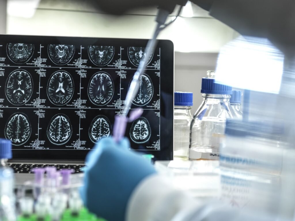Anvisa aprova 1º tratamento que promete retardar Alzheimer