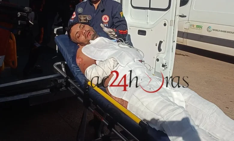Caldeira explode e deixa trabalhador ferido em fábrica de castanha | ac24horas Caldeira explode e deixa trabalhador ferido em fábrica de castanha | ac24horas