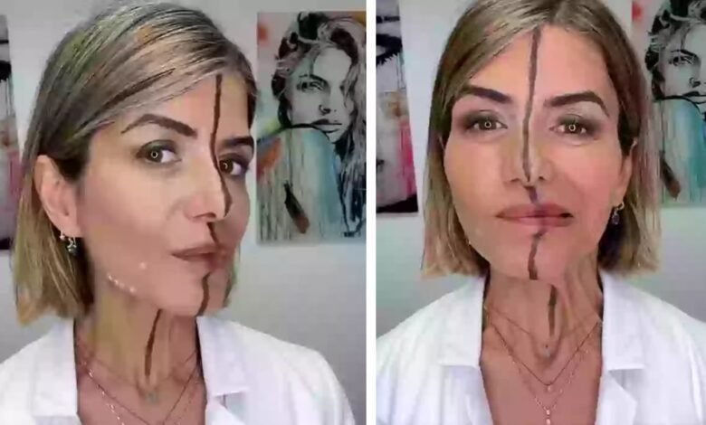 Médica aplica botox em apenas um lado do rosto para mostrar efeitos; veja Médica aplica botox em apenas um lado do rosto para mostrar efeitos; veja