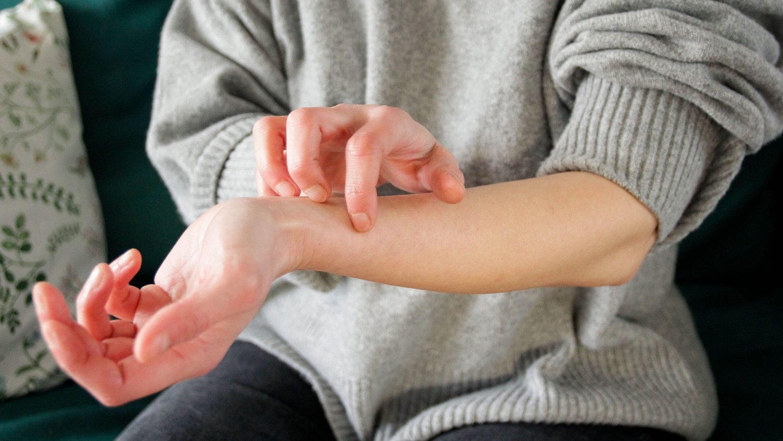 Dermatite atópica: novo medicamento é opção para casos moderados e graves