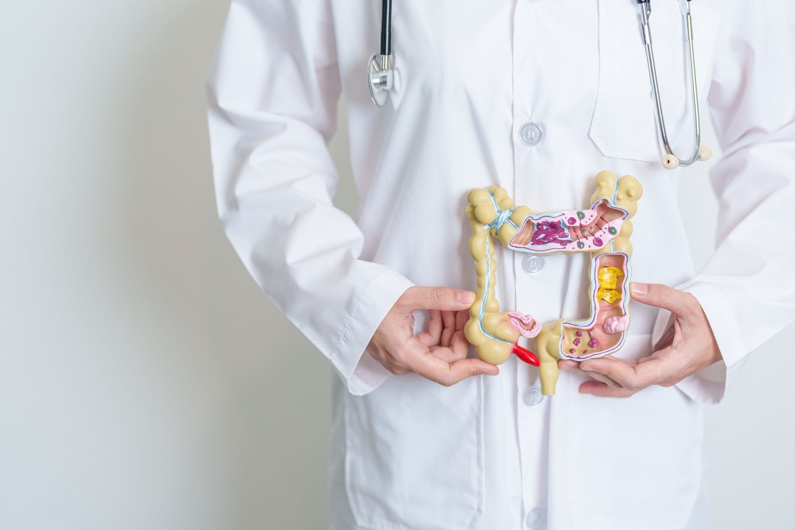 Câncer de intestino cresce entre jovens no mundo, alerta estudo