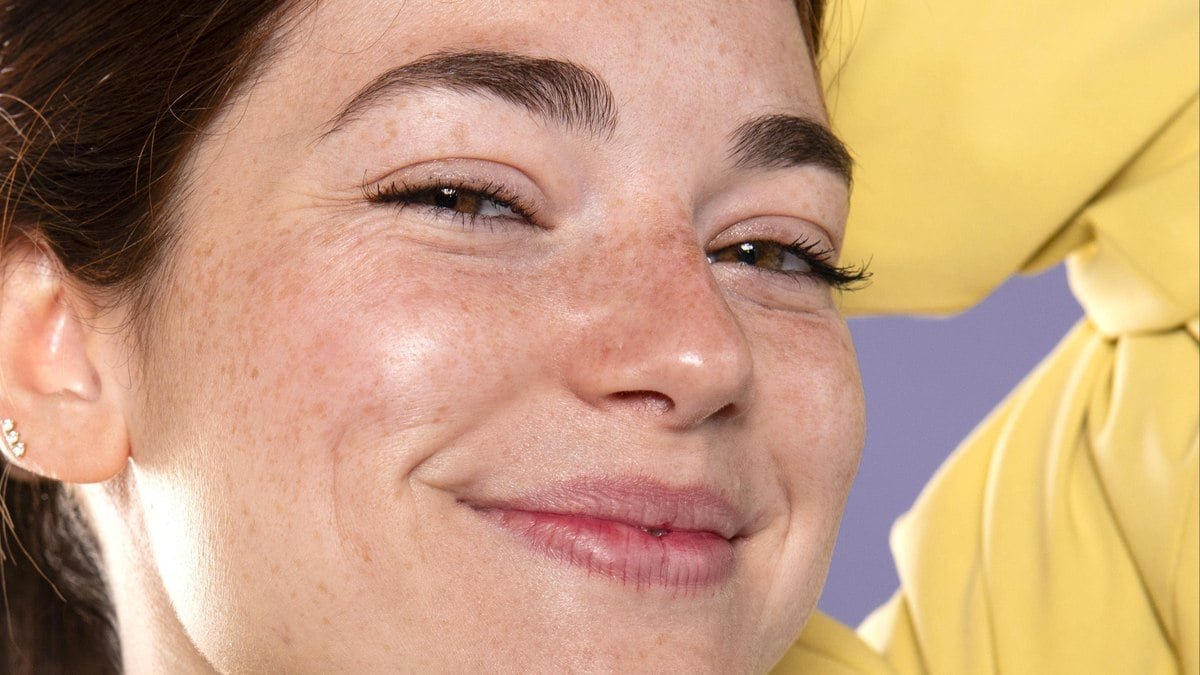 8 tipos de manchas no rosto: dermato aponta possíveis tratamentos
