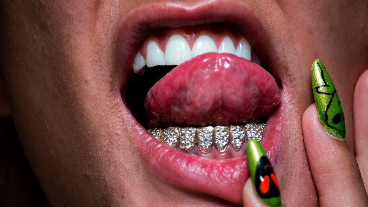 joias para os dentes que vem conquistando as celebridades joias para os dentes que vem conquistando as celebridades