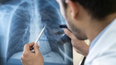 Entenda o que é pneumonia silenciosa, que tem alertado autoridades de saúde